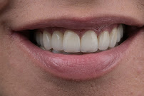 Esthetic Dental Center (Centar za estetsku stomatologiju)