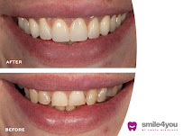 Dental - Smile4you by Sanja Nikolaus