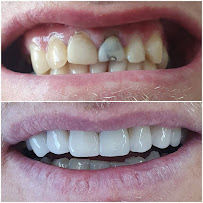 Dental - Centar Mimica