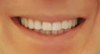 Save on Dental Care - SODC Dental Clinic