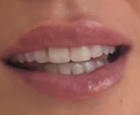 Avenue Dental Budapest