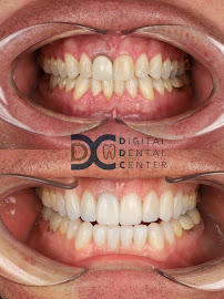 Digital Dental Center Pattaya - Specialized Dental Implant and Cosmetic, the Invisalign Diamond Provider in Pattaya.