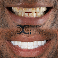 Digital Dental Center Pattaya - Specialized Dental Implant and Cosmetic, the Invisalign Diamond Provider in Pattaya.
