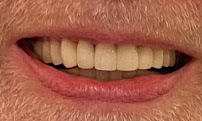Dental Smile Pattaya