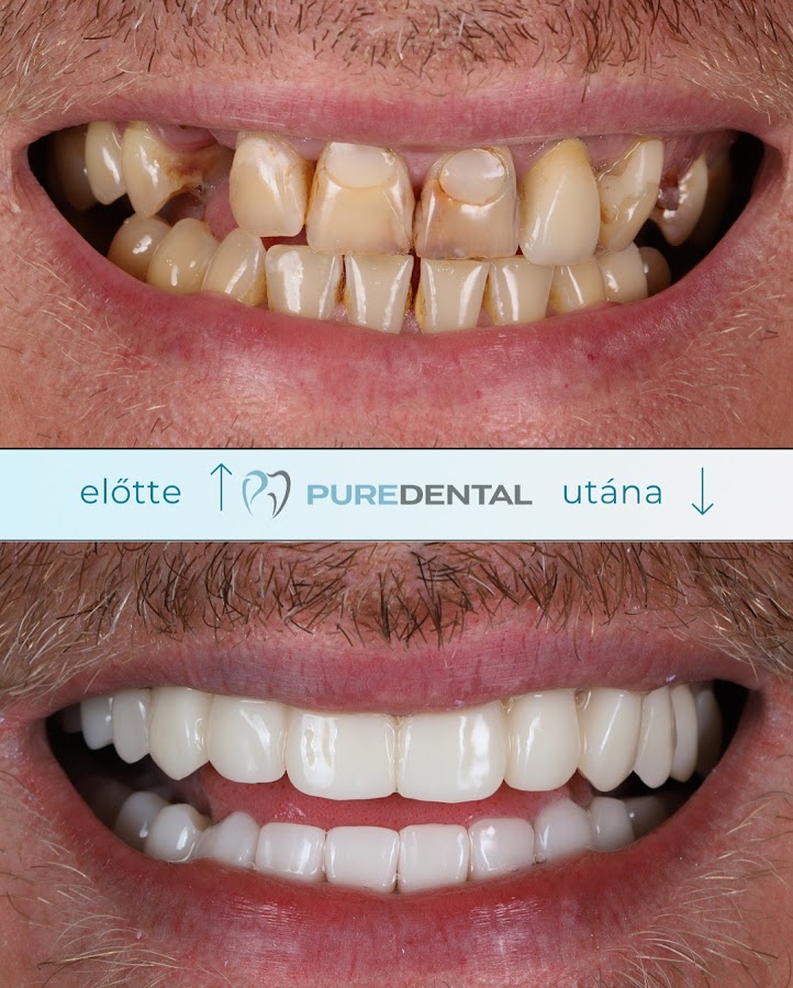 PureDental Fogászat - dental clinic in Budapest, Hungary