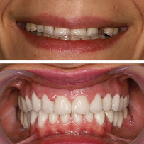 PureDental Fogászat