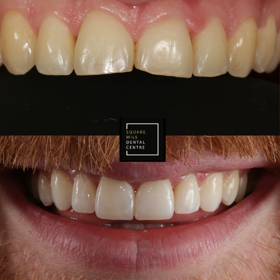 Square Mile Dental Centre - dental clinic in London, United Kingdom