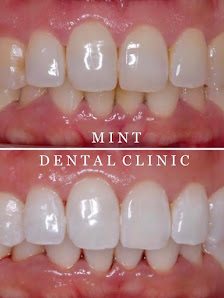Mint Dental Clinic