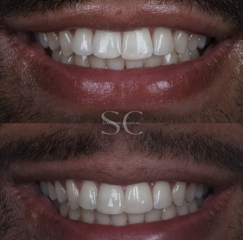 London Dental Implant - dental clinic in London, United Kingdom