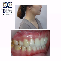 The Dental Design Center