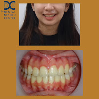 The Dental Design Center