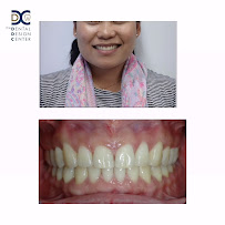 The Dental Design Center