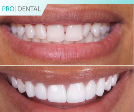 Pro Dental Clinic - dental clinic in London, United Kingdom