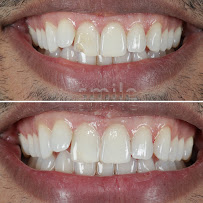 Smile Cliniq - St Johns Wood Dentist