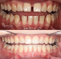 Smile Cliniq - St Johns Wood Dentist