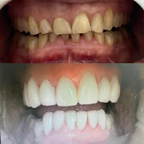 24 hour emergency dentist at Kings Cross Dental