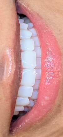 1 King's Dental (Soho)