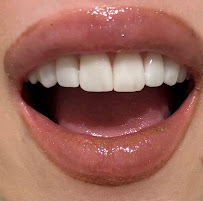 The Harley Street Smile Clinic