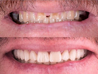 Dentavrasya Oral and Dental Health Polyclinic