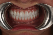 İdea Dental Clinic | dental implant | hollywood smile | gülüş tasarımı | ortodonti diş tedavisi | diş estetiği beyazlatma