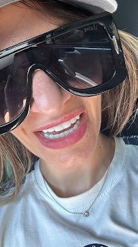 İdea Dental Clinic | dental implant | hollywood smile | gülüş tasarımı | ortodonti diş tedavisi | diş estetiği beyazlatma