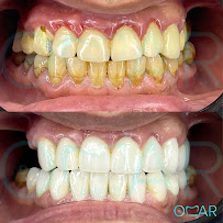 Diş hekimi .دكتور عمر عقيد Dr Omar Akeed Dental clinic