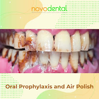 Novodental Adriatico