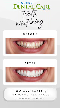 Bocobo Dental Care Co.