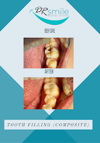 DR Smile Dental Clinic - Manila Branch