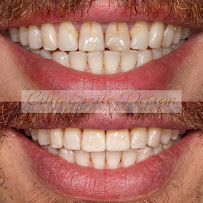Cillo Smile Design - Dental Clinic in Makati
