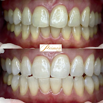 Primea Dental