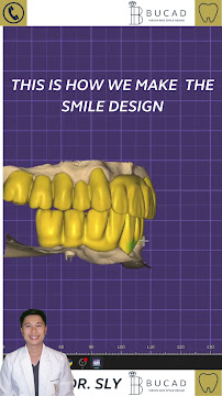 Bucad Vision And Smile Rehab