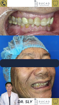 Bucad Vision And Smile Rehab