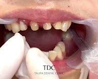 Taupa Dental Clinic (TDC Novaliches Branch)