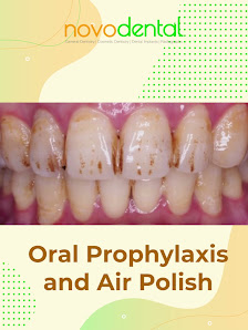 Novodental Ayala Malls the 30th