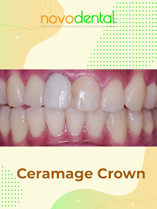 Novodental Ayala Malls the 30th