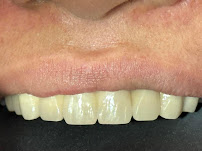 Dentocleene Dental Clinic-Buhangin