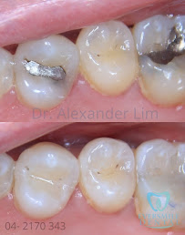 Eversmile Dental Penang (Invisalign & Braces, Dental Implant, Dental Aesthetic and General Dentistry Clinic)