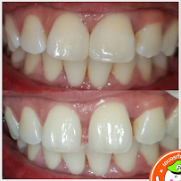 Amon Dental clinic (สาขาเนินพลับหวาน)