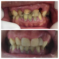 Family Dental Clinic: Best Dentist in Penang