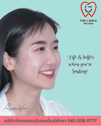 คลินิกทันตกรรมดิเอชสไมล์พัทยา The H Smile Dental Clinic Pattaya