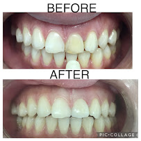 PS Dental Penang