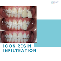 Metro Perdana Dental Clinic - Batu Lanchang (Invisalign Diamond Provider)