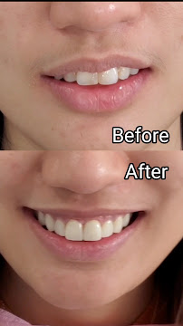 WhiteZone Dental Clinic
