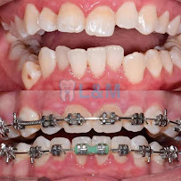 L&M Dental Clinic PJ (Dentist nearby ss2)
