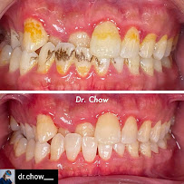 L&M Dental Clinic PJ (Dentist nearby ss2)