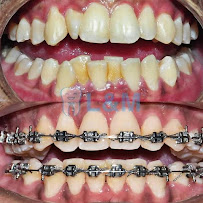 L&M Dental Clinic PJ (Dentist nearby ss2)