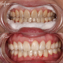 L&M Dental Clinic PJ (Dentist nearby ss2)