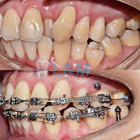 L&M Dental Clinic PJ (Dentist nearby ss2)