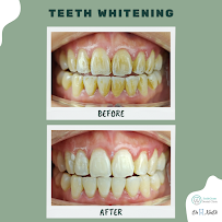 SmileGram Dental Clinic PJ (Petaling Jaya)
